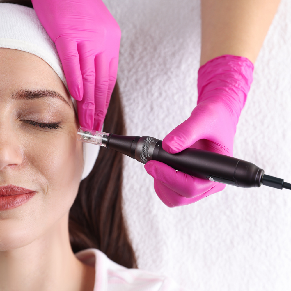 Microneedling